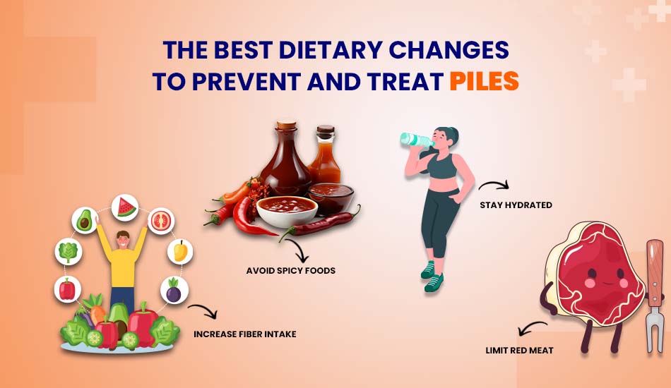 The Best Dietary Changes to Prevent and Treat Piles